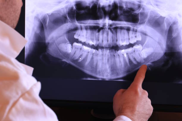 Best Tooth Infection Emergency Dentist  in Woodstock, AL