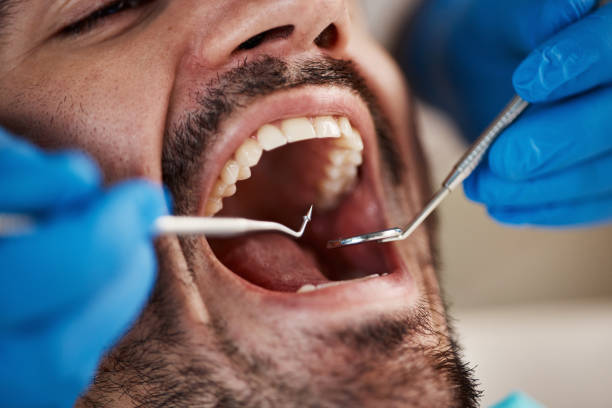 Best Knocked-Out Tooth Emergency  in Woodstock, AL